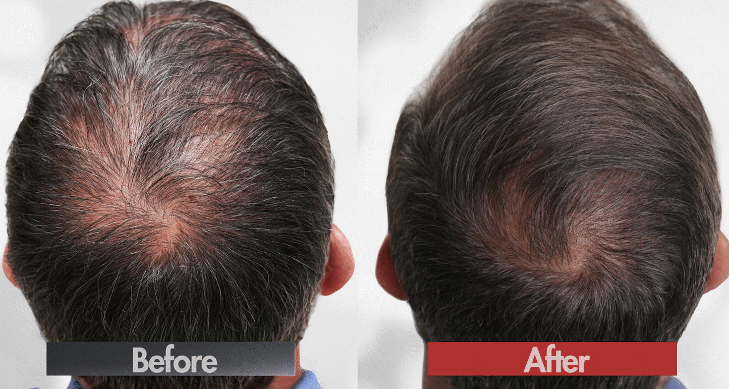 Adivasi Herbal Hair Oil